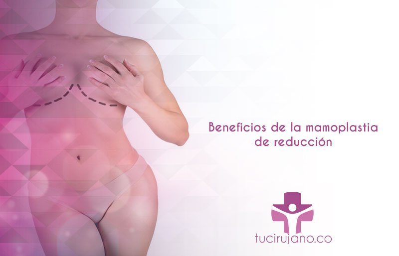 Beneficios de la mamoplastia de reducción