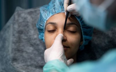 ¿Cuáles son los riesgos de la rinoplastia? Todo lo que necesitas saber