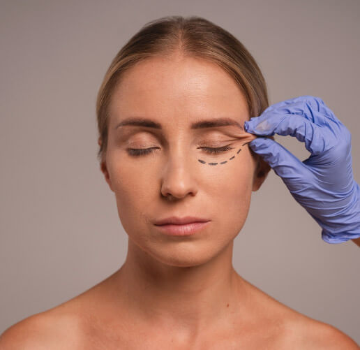 Blefaroplastia en Bogotá