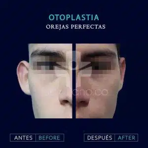 Cirugía reconstructiva y estética de orejas