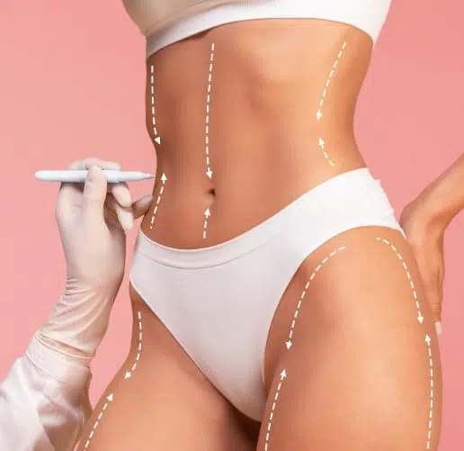 Cirujanos Plásticos Certificados en Bogotá