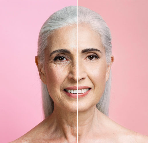 Rejuvenecimiento facial SIN cirugía en Bogotá