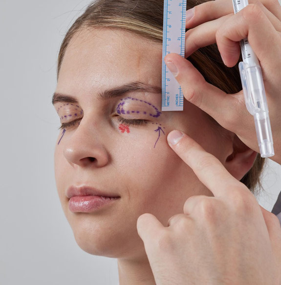 blefaroplastia cirugia de parpados bogota