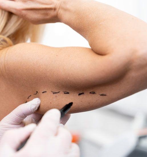 braquioplastia en Bogotá