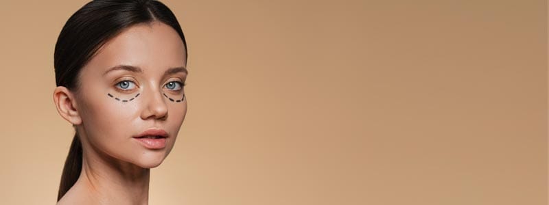 Precio Blefaroplastia Bogotá