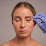 Blefaroplastia Precio Bogotá