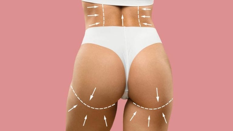 gluteoplastia precio colombia