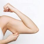 precio lifting brazos colombia