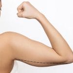 Precio Liposucción de Brazos Colombia