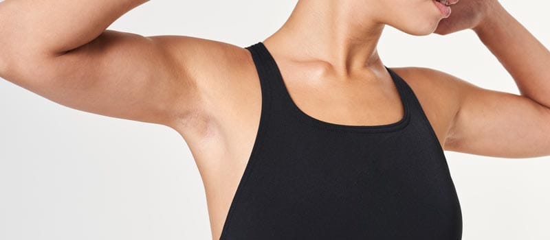 precio lipo de brazos