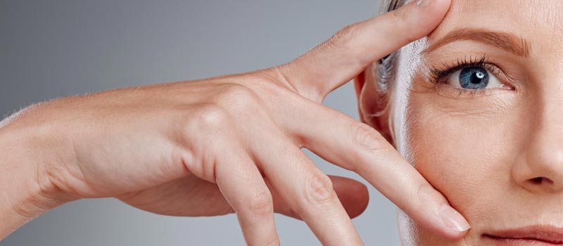 diferencias entre blefaroplastia funcional y estética