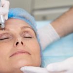 blefaroplastia funcional vs estética