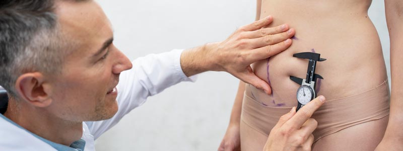 en que consiste la lipotransferencia