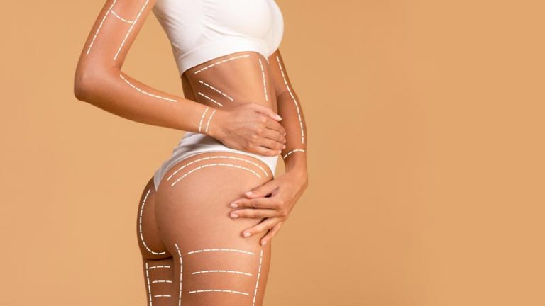 cuánto dura una lipotransferencia