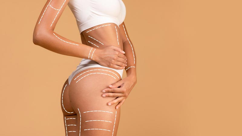 cuánto dura una lipotransferencia