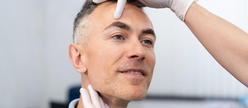 blefaroplastia funcional o estética cuál elegir