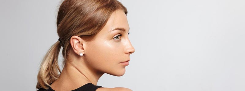 otoplastia definición