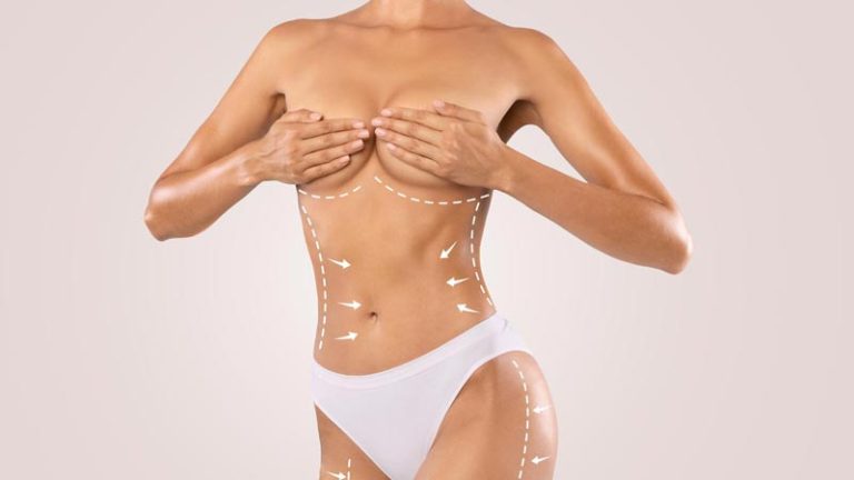 que es la lipotransferencia y como funciona