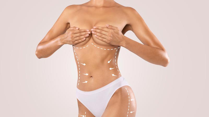 que es la lipotransferencia y como funciona