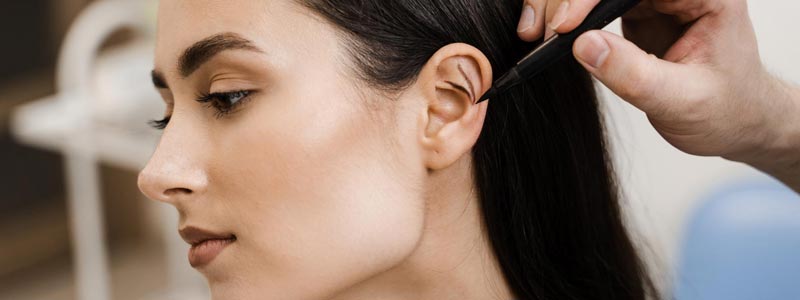 resultado final otoplastia