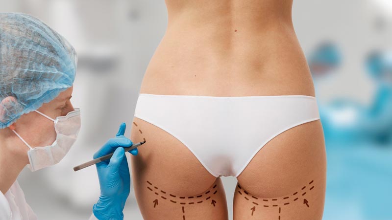 Riesgos de la lipotransferencia