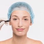 candidato a una blefaroplastia