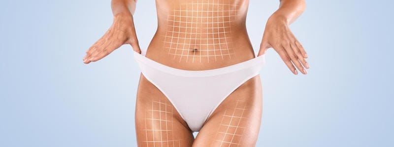 perfil paciente liposucción