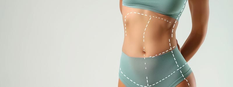 complicaciones liposucción