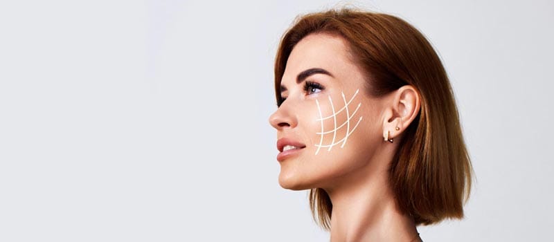 en qué consiste la bichectomía