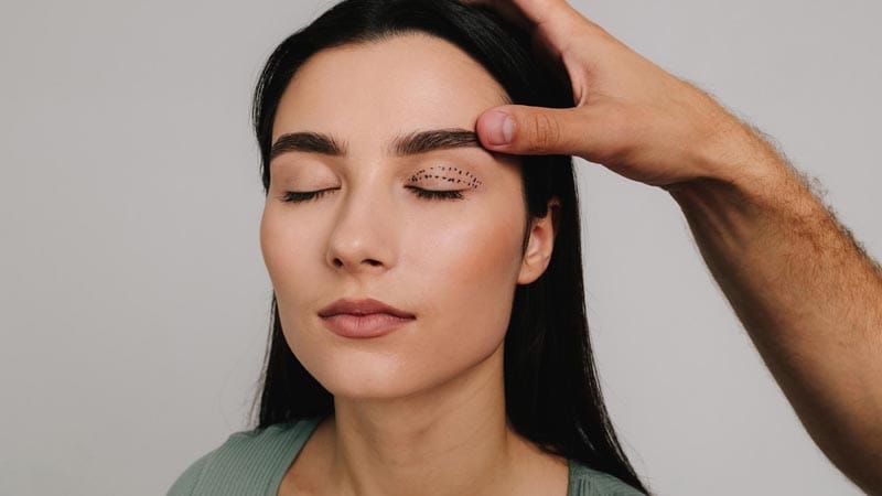 qué es la blefaroplastia