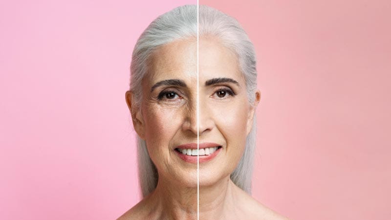qué es el endolifting facial