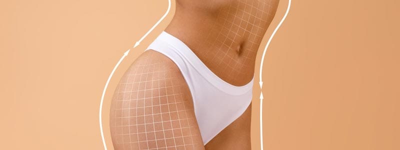 cómo funciona la liposucción