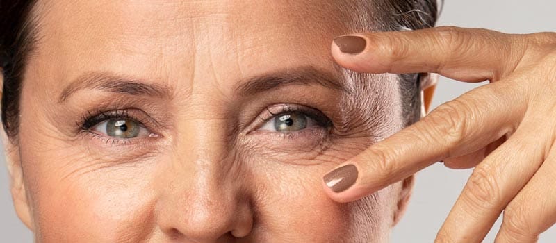 Edad ideal para una blefaroplastia