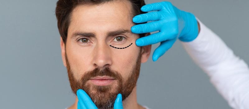 cuidados después de blefaroplastia