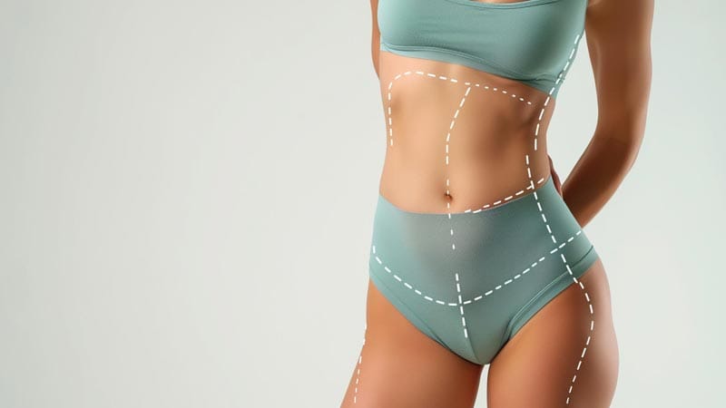 recuperación de la liposucción