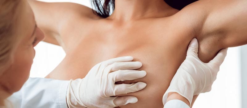 recuperación levantamiento de senos