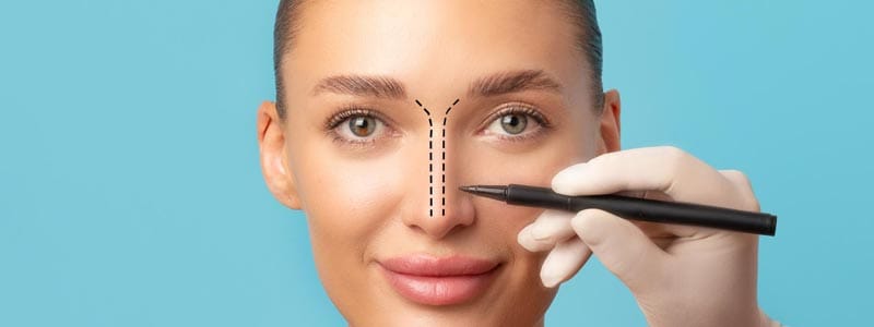 cuidados después de una rinoplastia