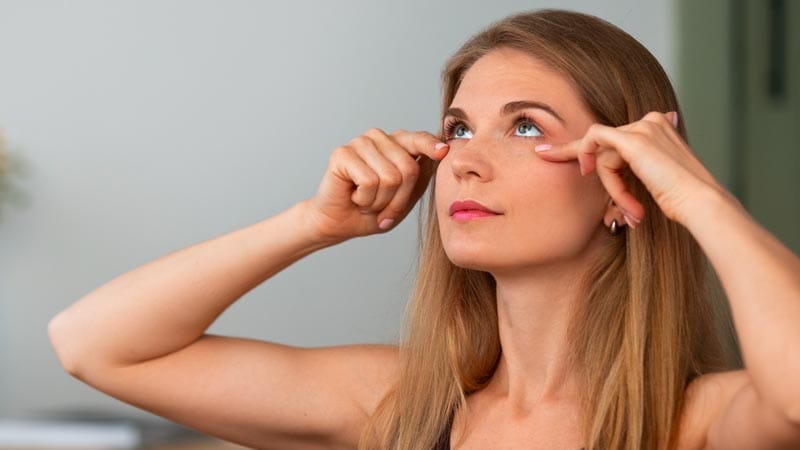 Resultados de la blefaroplastia