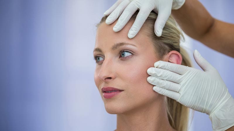 resultados del endolifting facial