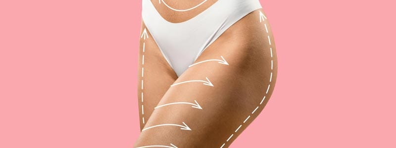 cuánto dura la recuperación de una liposucción