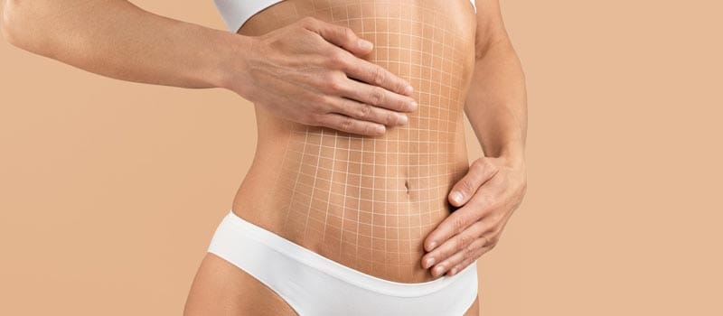 cómo se hace una lipo 360