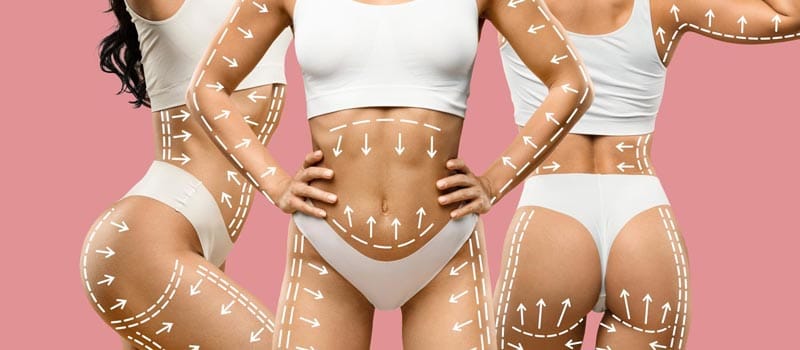 qué es el mommy makeover