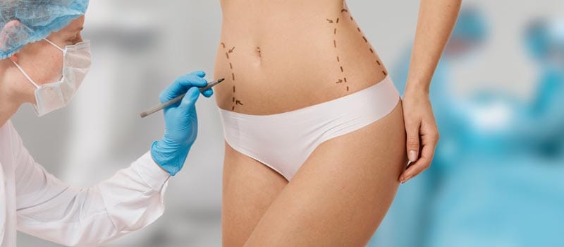 recuperación después de lipo 360