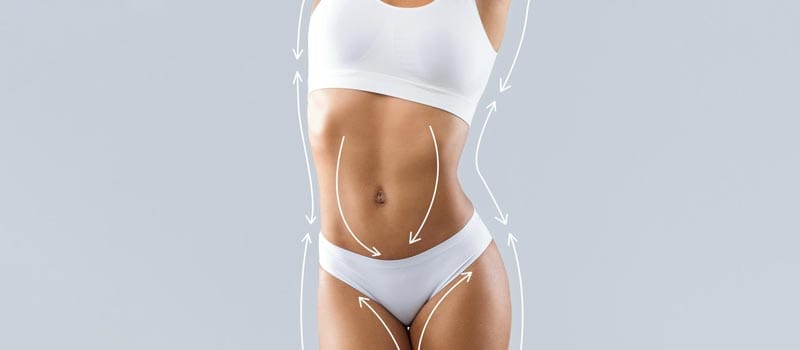antes y después lipo 360