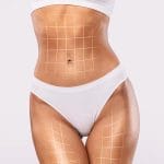 resultados de la Lipo 360