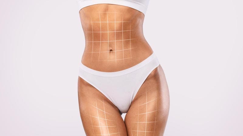 resultados de la Lipo 360