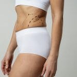 Riesgos de la Lipo 360