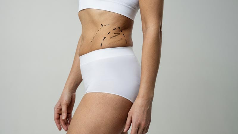 Riesgos de la Lipo 360