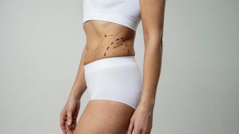 cuánta grasa se necesita para una lipotransferencia