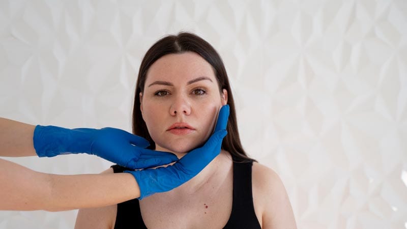 recuperación de la lipopapada